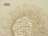 Sezione trasversale a livello di un soro di organi uniloculari